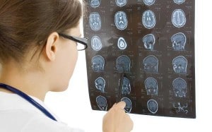 Tips For Filing For Disability Benefits After Suffering A Traumatic Brain Injury